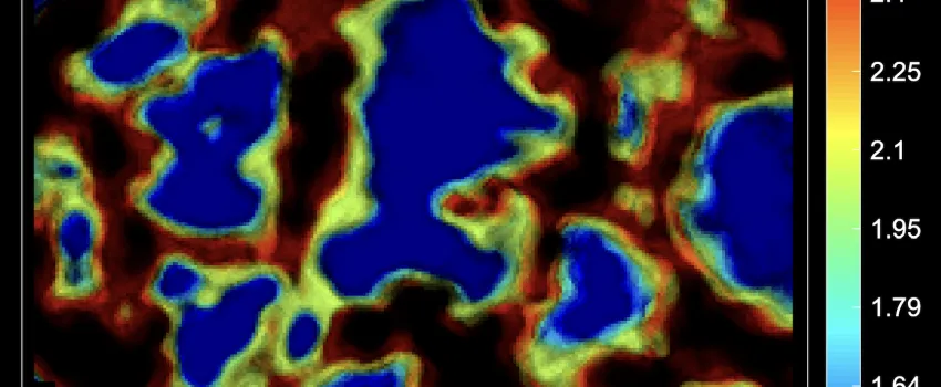New software from UHasselt and ZEISS shows in sharp detail how biomolecules move in cells.