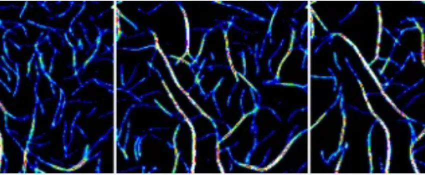 New protein function could explain cause of neurological disease